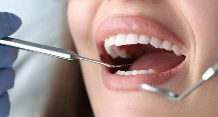 Продукты, делающие зубы уязвимыми: что опаснее сладостей